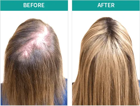 Ikaria Lean Belly Juice biogrow before after results